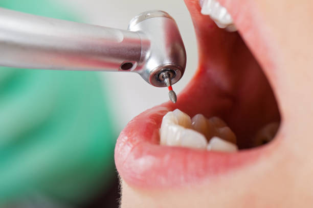 Best Emergency Dental Care for Broken or Chipped Teeth in Spencer, WI